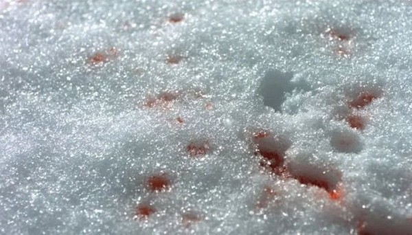 Снимал видео для тик-тока и попал в больницу. В Беларуси 10-летний мальчик прыгнул в сугроб — там оказалось стекло оконной рамы