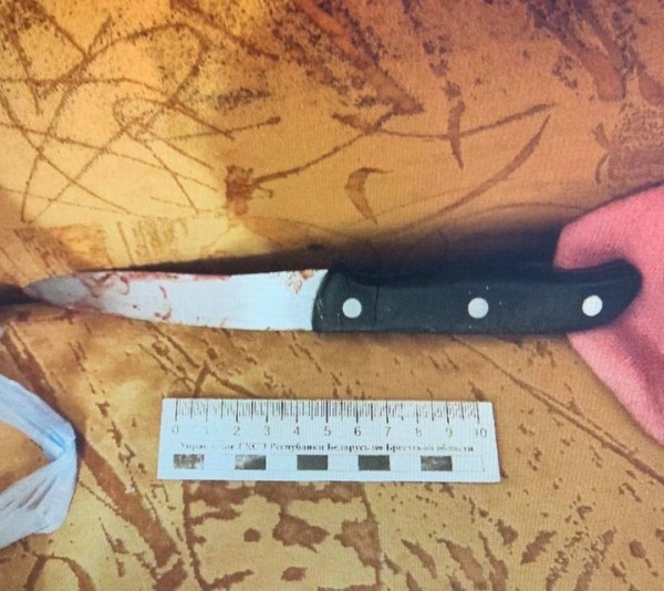 В Брестской области муж ударил жену ножом и электрошокером В Брестской области муж ударил жену ножом и электрошокером