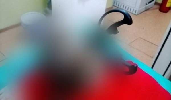 В Солигорске мать бросила кухонные ножницы в 12-летнюю дочь и сломала ей череп. Стали известны подробности В Солигорске мать бросила кухонные ножницы в 12-летнюю дочь и сломала ей череп. Стали известны подробности