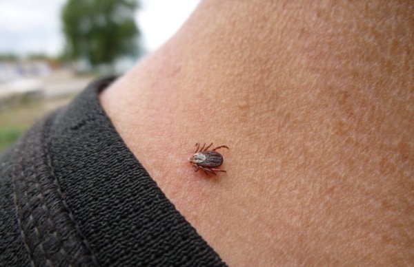 &laquo;Очень важно вовремя удалить клеща&raquo;. Белорусский врач рассказал, как проявляется клещевой боррелиоз