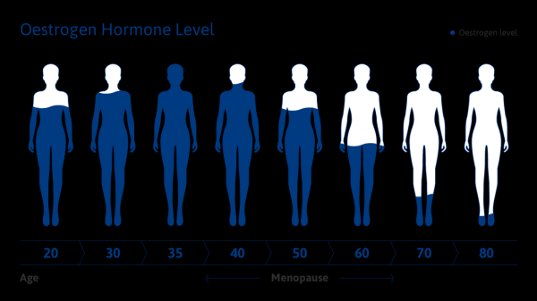Истории белорусок, которые не желают стареть