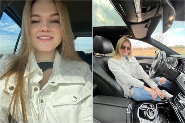 Потратил на зубы $15 тысяч — это того стоило? Белорусы, которые решились на брекеты во взрослом возрасте