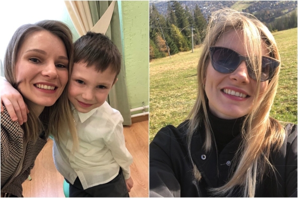 Потратил на зубы $15 тысяч — это того стоило? Белорусы, которые решились на брекеты во взрослом возрасте