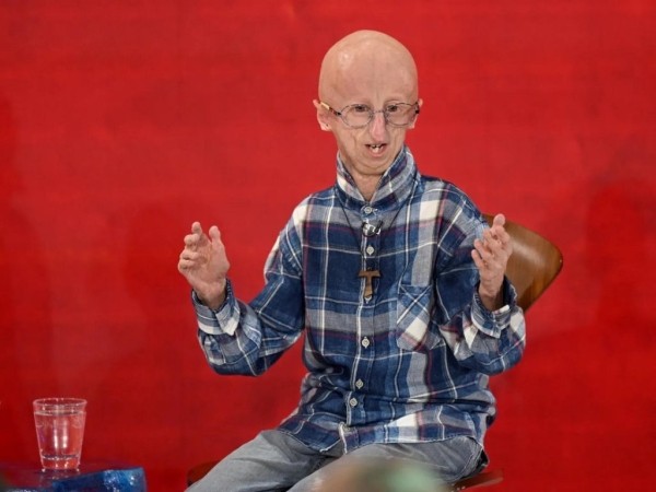 Умер самый долгоживущий человек с синдромом преждевременного старения — ему было 28 лет